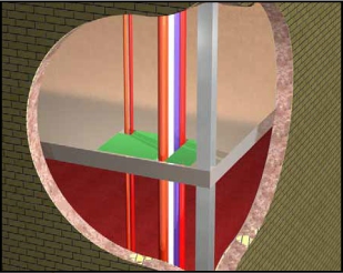 Dura grating reduces risks1